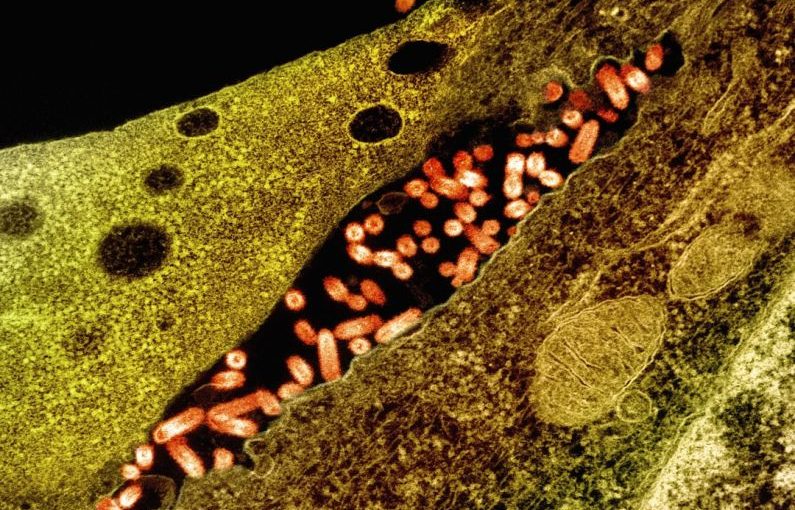 Fish Diseases - a close up of an animal cell structure